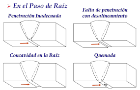 tipos del cordon